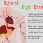 Symptoms of High Cholesterol in Females