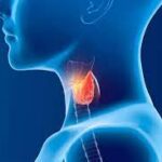 Metabolic and Endocrine Disorders